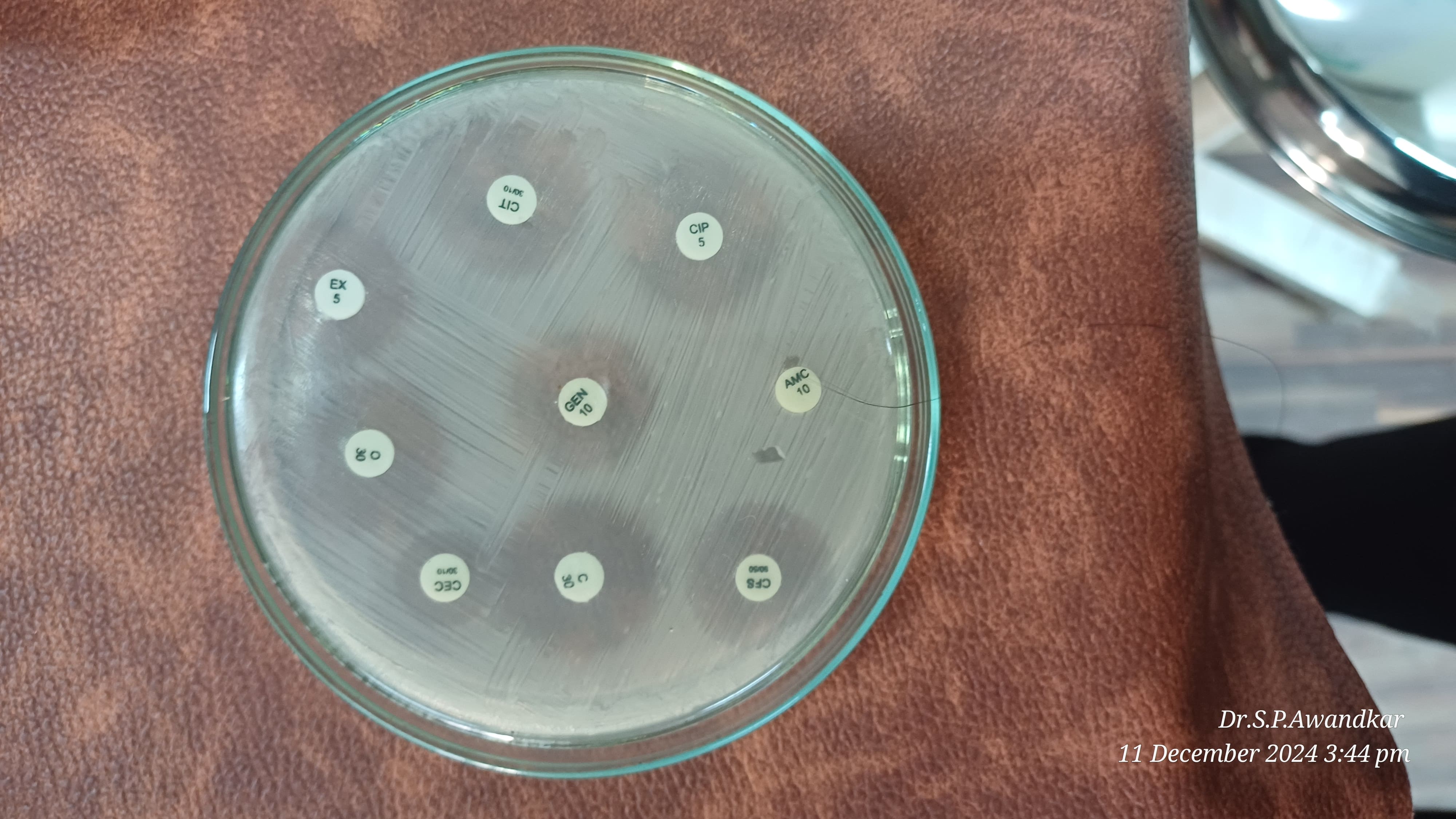 24. Antibiotic Sensitivity Test